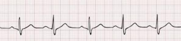 График на разлинованной бумаге